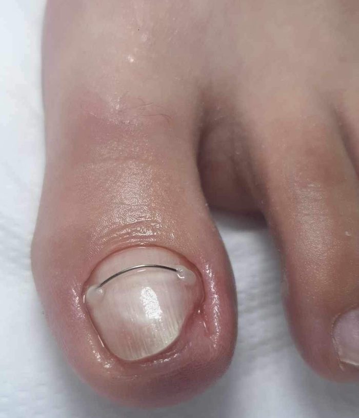 Curs Pedichiură Complexă
